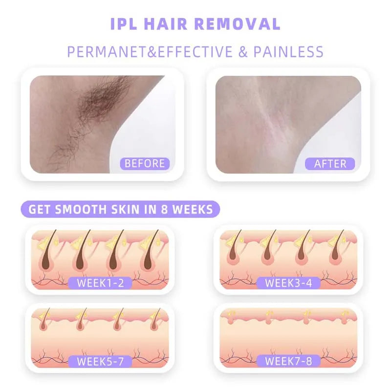 ✨ Veloura Silk™ | Depiladora IPL de Luz Pulsada.